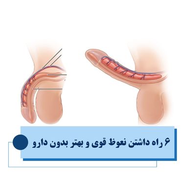 6 راه داشتن نعوظ قوی و بهتر بدون دارو